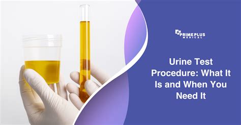 refractometer sop urinalysis|urine testing procedure.